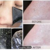 Blackhead Nose Patches, Deep Cleansing Nasal Spot Facial Dot Stickers, Nose Mask Shill For Improving The Look Of Acne & Black Head